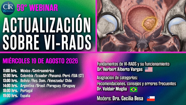 59° Webinar