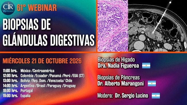 61° Webinar
